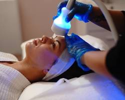 The Cold Rush: 5 Reasons to Choose Professional Cryo-Facials for Instant Lift